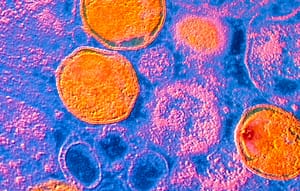 Susceptibilidad antimicrobiana en muestras urogenitales de Ureaplasma urealyticum, el principal agente en infección intramaniótica