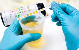 La microalbuminuria como factor pronóstico en un grupo de pacientes hipertensos de una entidad de primer nivel