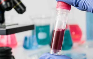Sistemas de gestión de calidad aplicada a áreas de química clínica y hematología: ISO 9001:2015