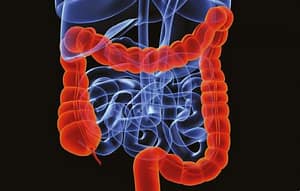 Diagnóstico y seguimiento de pacientes con sangre oculta positiva en heces fecales