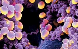 Vigilancia microbiológica de la resistencia bacteriana en Staphylococcus meticilina resistente. Hospital Universitario General Calixto García. Años 2015-2017