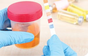 Significado de la proteinuria en el niño y adolescente. Consenso