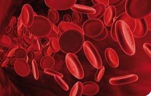 Hemofilia A neonatal: reporte de un caso en Sincelejo (Colombia). Caso clínico