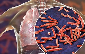 Predictores de tuberculosis pulmonar y experiencia con su diagnóstico molecular rápido