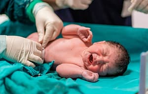 Atención al neonato expuesto o infectado con el virus varicela-zoster