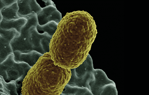 Resistencia antimicrobiana de Enterobacterias causante de infección del tracto urinario en pacientes ambulatorios