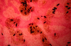 Anticuerpos de Cadena Única de Alpaca para la detección de Antígenos de Fasciola Hepática