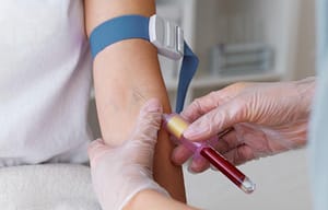 Impacto de la seguridad del paciente en la calidad de los servicios de laboratorio clínico