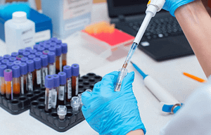 Errores preanalíticos en laboratorios clínicos: revisión integrativa