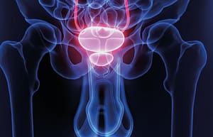 Una mirada global y actualizada del cáncer de próstata