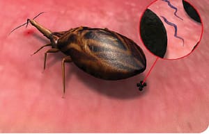 Comparación de siete pruebas diagnósticas para detectar infección por Trypanosoma cruzi en pacientes en fase crónica de la enfermedad de Chagas