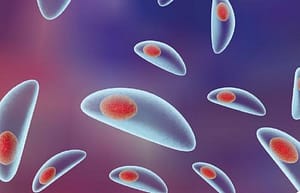 Comparación entre metodologías para la detección de IgG Anti Toxoplasma gondii en suero