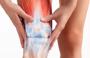 Esterasa leucocitaria como prueba diagnóstica ante un proceso infeccioso articular de rodilla