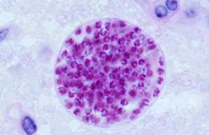 Técnica de Sedimentación Espontánea en Tubo para Diagnóstico de Enteroparasitosis en Centros de Salud de Primer Nivel