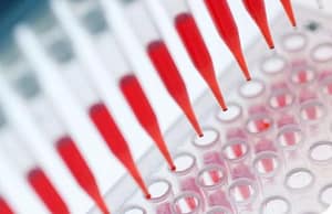 La técnica MABA (Multiple Antigen Blot Assay): una aproximación de bajo costo al diagnóstico simultáneo de múltiples enfermedades infecciosas