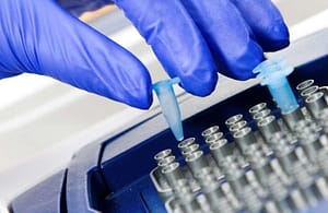 Uso de herramientas moleculares en el diagnóstico de parasitosis: PCR en tiempo real, iniciativas en enfermedad de Chagas