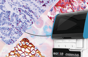 automatización de la inmunohistoquímica con tecnología avanzada