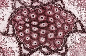 Frecuencia de las mutaciones más comunes del gen CFTR en pacientes peruanos con fibrosis quística mediante la técnica ARMS-PCR