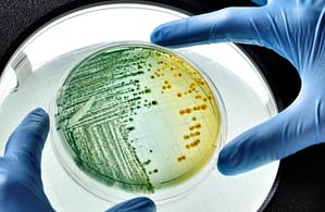 Infecciones Urinarias Complicadas