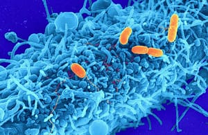 Efectividad del sistema de puntuación de Nugent en el diagnóstico de vaginosis bacteriana