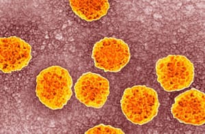 Detección de anticuerpos contra el virus de la hepatitis C en donantes de sangre voluntarios