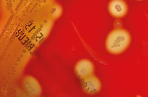 Detección de la colonización asintomática en orofaringe por Streptococcus pyogenes mediante dos métodos diagnósticos