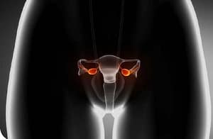 Niveles de hormona antimulleriana y factor neurotrófico derivado del cerebro como predictores de función ovárica