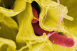 Características clínicas y mortalidad de pacientes adultos con síndrome hemafagocítico, estudio de cohorte retrospectiva