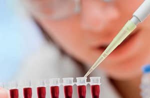 Los Virotroles® como alternativa para control de calidad interno en pruebas de tamizaje serológico de muestras de donantes de sangre en el Banco de Sangre del Complejo Hospitalario Metropolitano Dr. Arnulfo Arias Madrid (C. H. Dr. A. A