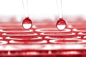 Comparación entre el diagnóstico serológico y el diagnóstico por reacción en cadena de la polimerasa (PCR) para Escherichia Coli enteropatogénica (EPEC)