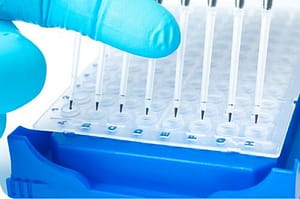 Uso de PCR múltiple en el diagnóstico simultáneo de parasitosis