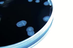 Resistencia transferible a quinolonas en enterobacterias productoras de BLEE en un hospital pediátrico del Uruguay