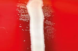 Evaluación de la susceptibilidad directa desde hemocultivos positivos utilizando el sistema Vitek 2: comparación de dos protocolos rápidos