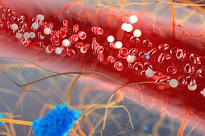 Anemia hemolítica autoinmune por anticuerpos calientes secundaria a hipertiroidismo. Revisión de la literatura