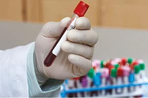 Nuevas pruebas diagnósticas en paneles sindrómicos