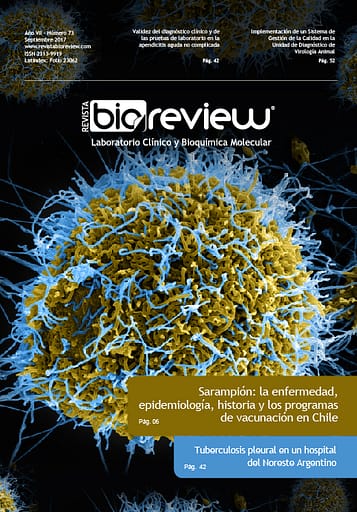Sarampión: la enfermedad, epidemiología, historia y los programas de vacunación en Chile