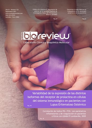 Variabilidad de la expresión de las distintas Isoformas del receptor de prolactina en células del sistema inmunológico en pacientes con Lupus Eritematoso Sistémico