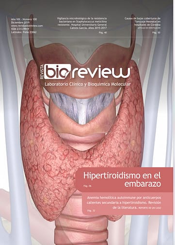 Hipertiroidismo en el embarazo