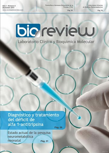 Diagnóstico y tratamiento del déficit de alfa 1- antitripsina