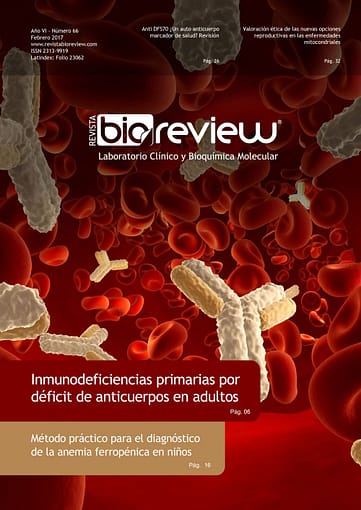 Inmunodeficiencias primarias por déficit de anticuerpos en adultos
