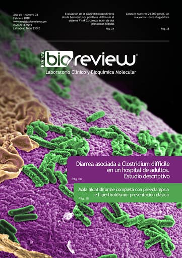 Diarrea asociada a Clostridium difficile en un hospital de adultos. Estudio descriptivo