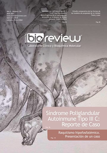 Síndrome Poliglandular Autoinmune Tipo III C