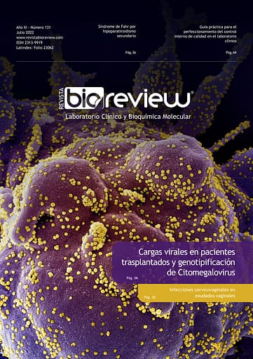 Cargas virales en pacientes trasplantados y genotipificación de Citomegalovirus