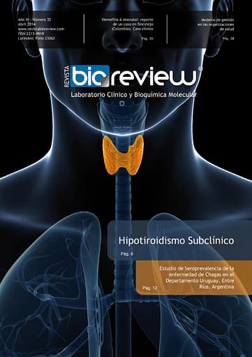 Hipotiroidismo Subclínico