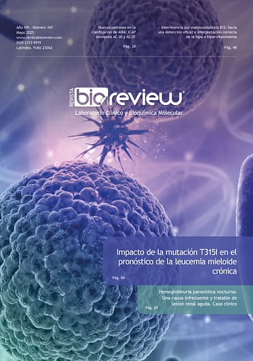 Impacto de la mutación T315I en el pronóstico de la leucemia mieloide crónica
