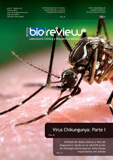 Virus Chikungunya