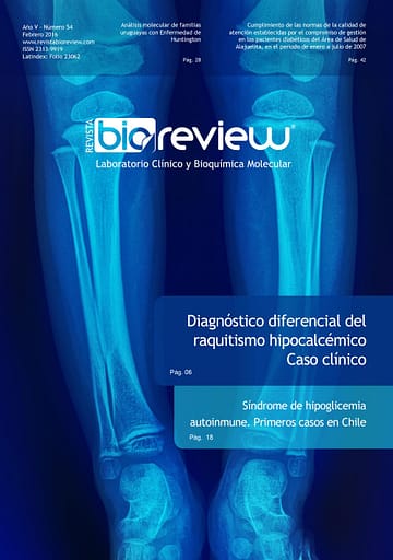 Diagnóstico diferencial del raquitismo hipocalcémico
