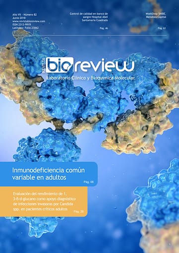 Inmunodeficiencia común variable en adultos