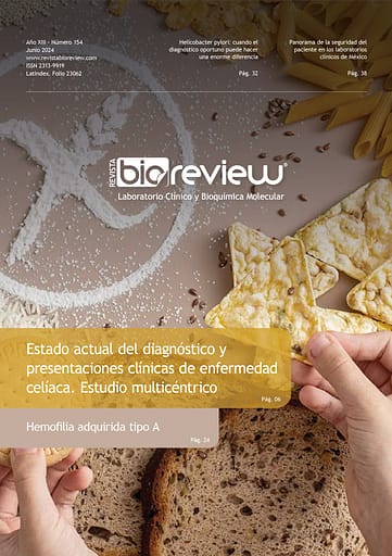 Estado actual del diagnóstico y presentaciones clínicas de enfermedad celíaca. Estudio multicéntrico