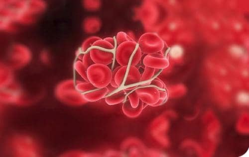 El laboratorio en Trombofilia